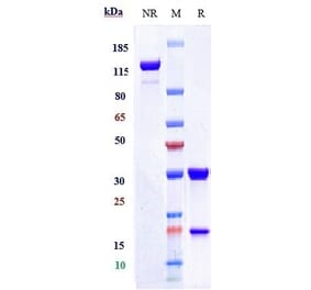 SDS-PAGE - Tusamitamab Biosimilar - Anti-CEACAM5 Antibody - Low endotoxin, Azide free (A323808) - Antibodies.com