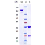 SDS-PAGE - Tusamitamab Biosimilar - Anti-CEACAM5 Antibody - Low endotoxin, Azide free (A323808) - Antibodies.com