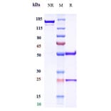 SDS-PAGE - Ublituximab Biosimilar - Anti-CD20 Antibody - Low endotoxin, Azide free (A323809) - Antibodies.com