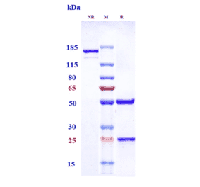 SDS-PAGE - Upifitamab Biosimilar - Anti-SLC34A2 Antibody - Low endotoxin, Azide free (A323813) - Antibodies.com