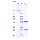 SDS-PAGE - Upifitamab Biosimilar - Anti-SLC34A2 Antibody - Low endotoxin, Azide free (A323813) - Antibodies.com