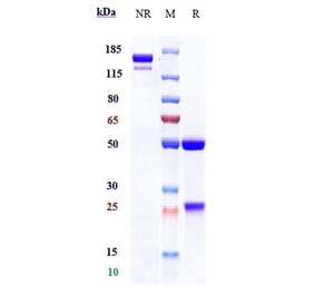 SDS-PAGE - Utomilumab Biosimilar - Anti-CD137 Antibody - Low endotoxin, Azide free (A323816) - Antibodies.com