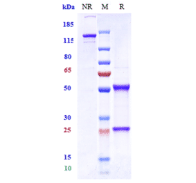 SDS-PAGE - Vandortuzumab Biosimilar - Anti-STEAP1 Antibody - Low endotoxin, Azide free (A323819) - Antibodies.com