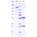 SDS-PAGE - Vandortuzumab Biosimilar - Anti-STEAP1 Antibody - Low endotoxin, Azide free (A323819) - Antibodies.com