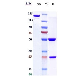 SDS-PAGE - Varlilumab Biosimilar - Anti-CD27 Antibody - Low endotoxin, Azide free (A323822) - Antibodies.com