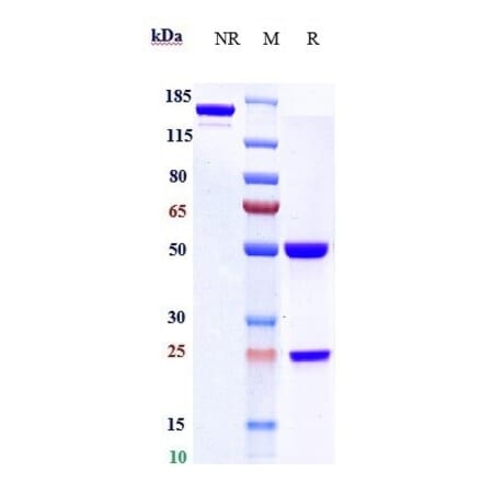 SDS-PAGE - Varlilumab Biosimilar - Anti-CD27 Antibody - Low endotoxin, Azide free (A323822) - Antibodies.com
