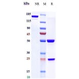 SDS-PAGE - Varlilumab Biosimilar - Anti-CD27 Antibody - Low endotoxin, Azide free (A323822) - Antibodies.com