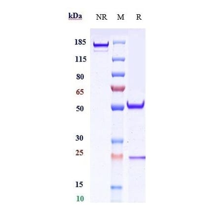 SDS-PAGE - Veltuzumab Biosimilar - Anti-CD20 Antibody - Low endotoxin, Azide free (A323825) - Antibodies.com