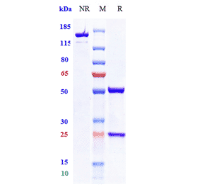 SDS-PAGE - Vibostolimab Biosimilar - Anti-TIGIT Antibody - Low endotoxin, Azide free (A323827) - Antibodies.com