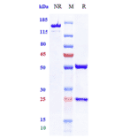 SDS-PAGE - Vibostolimab Biosimilar - Anti-TIGIT Antibody - Low endotoxin, Azide free (A323827) - Antibodies.com