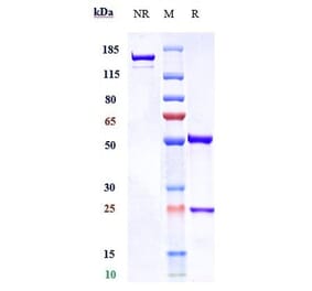 SDS-PAGE - Visilizumab Biosimilar - Anti-CD3 Antibody - Low endotoxin, Azide free (A323829) - Antibodies.com