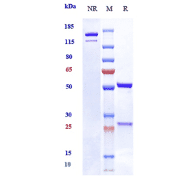 SDS-PAGE - Vixarelimab Biosimilar - Anti-OSMR Antibody - Low endotoxin, Azide free (A323830) - Antibodies.com