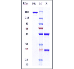 SDS-PAGE - Vofatamab Biosimilar - Anti-FGFR3 Antibody - Low endotoxin, Azide free (A323832) - Antibodies.com