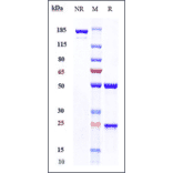 SDS-PAGE - Vofatamab Biosimilar - Anti-FGFR3 Antibody - Low endotoxin, Azide free (A323832) - Antibodies.com