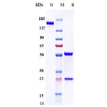 SDS-PAGE - Volagidemab Biosimilar - Anti-Glucagon Receptor Antibody - Low endotoxin, Azide free (A323833) - Antibodies.com