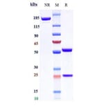 SDS-PAGE - Volociximab Biosimilar - Anti-Integrin alpha 5 + beta 1 Antibody - Low endotoxin, Azide free (A323834) - Antibodies.com