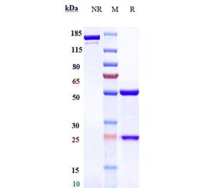 SDS-PAGE - Vorsetuzumab Biosimilar - Anti-CD70 Antibody - Low endotoxin, Azide free (A323838) - Antibodies.com
