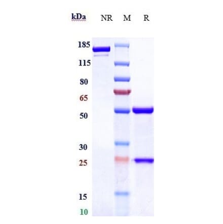 SDS-PAGE - Vorsetuzumab Biosimilar - Anti-CD70 Antibody - Low endotoxin, Azide free (A323838) - Antibodies.com