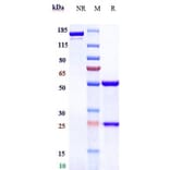 SDS-PAGE - Vorsetuzumab Biosimilar - Anti-CD70 Antibody - Low endotoxin, Azide free (A323838) - Antibodies.com