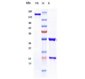 SDS-PAGE - Vunakizumab Biosimilar - Anti-IL-17A Antibody - Low endotoxin, Azide free (A323840) - Antibodies.com