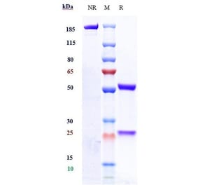 SDS-PAGE - Zagotenemab Biosimilar - Anti-Tau Antibody - Low endotoxin, Azide free (A323843) - Antibodies.com