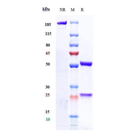 SDS-PAGE - Zagotenemab Biosimilar - Anti-Tau Antibody - Low endotoxin, Azide free (A323843) - Antibodies.com