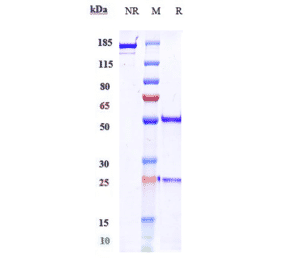 SDS-PAGE - Zalifrelimab Biosimilar - Anti-CTLA4 Antibody - Low endotoxin, Azide free (A323844) - Antibodies.com