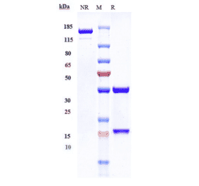 SDS-PAGE - Zalutumumab Biosimilar - Anti-EGFR Antibody - Low endotoxin, Azide free (A323845) - Antibodies.com