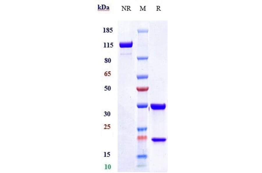 SDS-PAGE - Zampilimab Biosimilar - Anti-Transglutaminase 2 Antibody - Low endotoxin, Azide free (A323846) - Antibodies.com