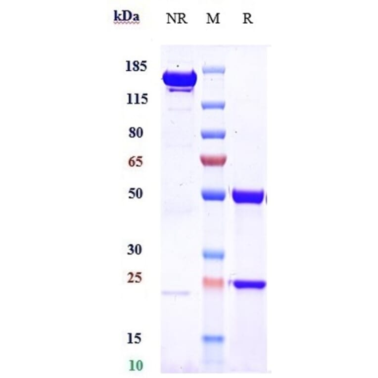 SDS-PAGE - Zanidatamab Biosimilar - Anti-ErbB2/HER2 Antibody - Low endotoxin, Azide free (A323847) - Antibodies.com
