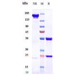 SDS-PAGE - Zanidatamab Biosimilar - Anti-ErbB2/HER2 Antibody - Low endotoxin, Azide free (A323847) - Antibodies.com