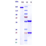 SDS-PAGE - Zelminemab Biosimilar - Anti-PACAP Receptor/ADCYAP1R1 Antibody - Low endotoxin, Azide free (A323849) - Antibodies.com