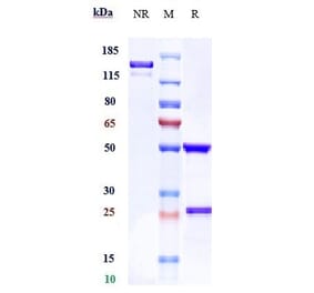SDS-PAGE - Zilovertamab Biosimilar - Anti-ROR1 Antibody - Low endotoxin, Azide free (A323851) - Antibodies.com