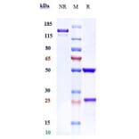 SDS-PAGE - Zilovertamab Biosimilar - Anti-ROR1 Antibody - Low endotoxin, Azide free (A323851) - Antibodies.com