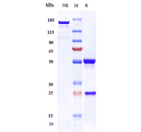 SDS-PAGE - Ziltivekimab Biosimilar - Anti-IL-6 Antibody - Low endotoxin, Azide free (A323852) - Antibodies.com
