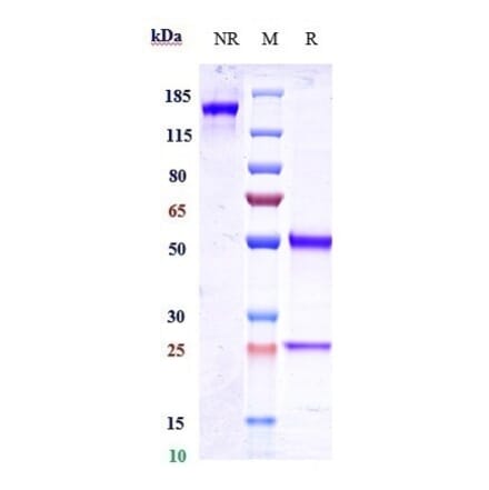 SDS-PAGE - Zuberitamab Biosimilar - Anti-CD20 Antibody - Low endotoxin, Azide free (A323856) - Antibodies.com