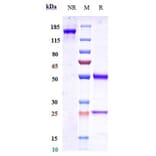 SDS-PAGE - Zuberitamab Biosimilar - Anti-CD20 Antibody - Low endotoxin, Azide free (A323856) - Antibodies.com