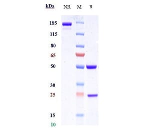 SDS-PAGE - Anti-c-Kit Antibody [CDX-0158] - Low endotoxin, Azide free (A323860) - Antibodies.com