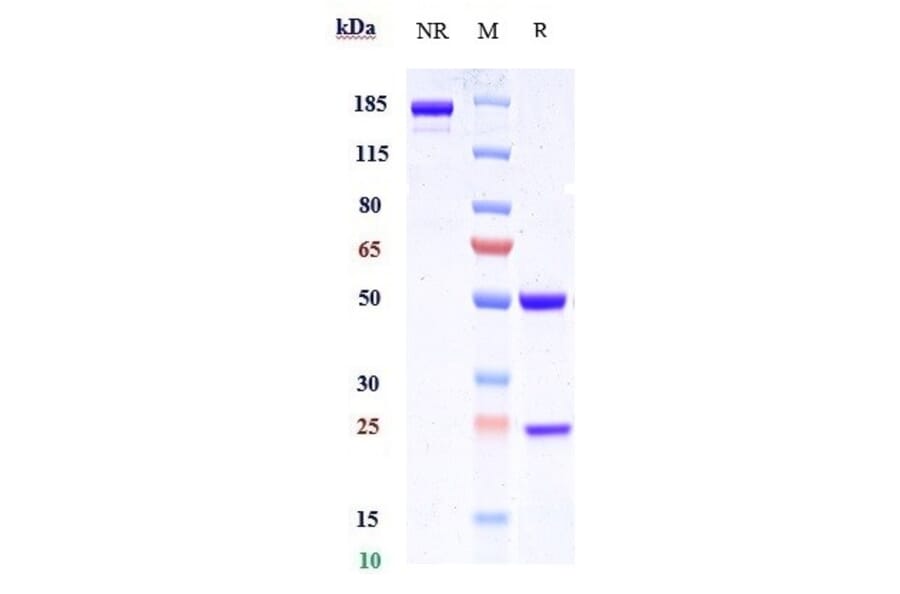 SDS-PAGE - Anti-c-Kit Antibody [CDX-0158] - Low endotoxin, Azide free (A323860) - Antibodies.com