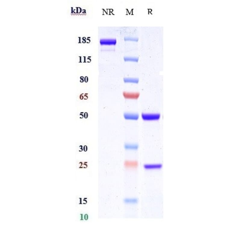 SDS-PAGE - Anti-c-Kit Antibody [CDX-0158] - Low endotoxin, Azide free (A323860) - Antibodies.com