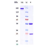 SDS-PAGE - Anti-c-Kit Antibody [CDX-0158] - Low endotoxin, Azide free (A323860) - Antibodies.com