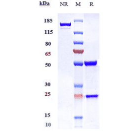 SDS-PAGE - Anti-c-Kit Antibody [LOP628] - Low endotoxin, Azide free (A323861) - Antibodies.com