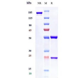 SDS-PAGE - Anti-Interferon alpha/beta Receptor 1 Antibody [Research Grade Biosimilar] - Low endotoxin, Azide free (A323863) - Antibodies.com