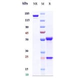 SDS-PAGE - Anti-Melanoma gp100 Antibody [Research Grade Biosimilar] - Low endotoxin, Azide free (A323864) - Antibodies.com