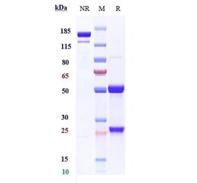 SDS-PAGE - Anti-Melanoma gp100 Antibody [Research Grade Biosimilar] - Low endotoxin, Azide free (A323865) - Antibodies.com