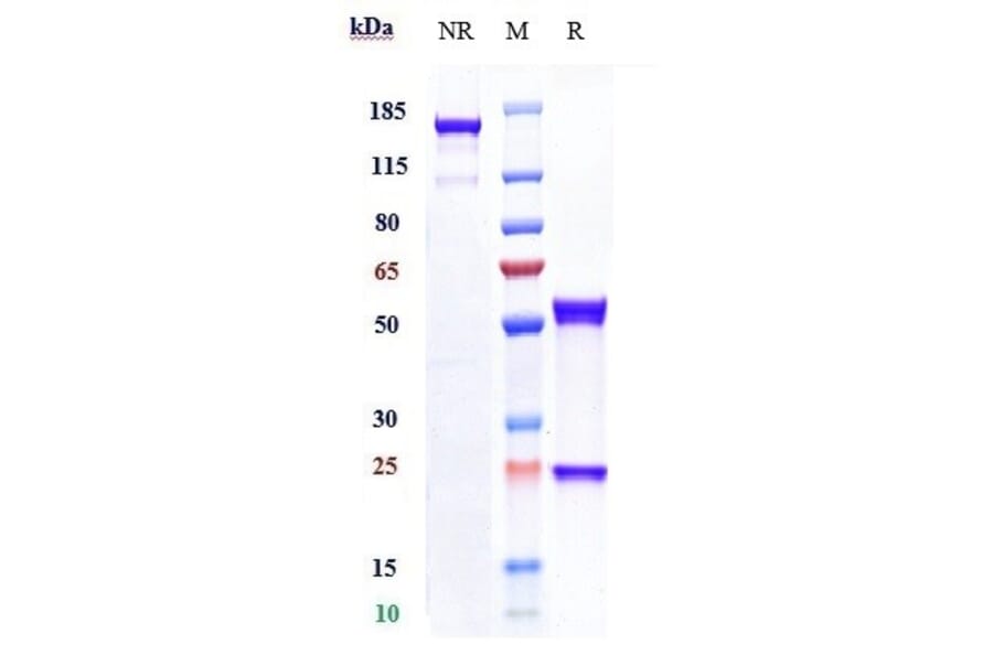 SDS-PAGE - Anti-uPA Receptor/U-PAR Antibody [ATN-658] - Low endotoxin, Azide free (A323866) - Antibodies.com