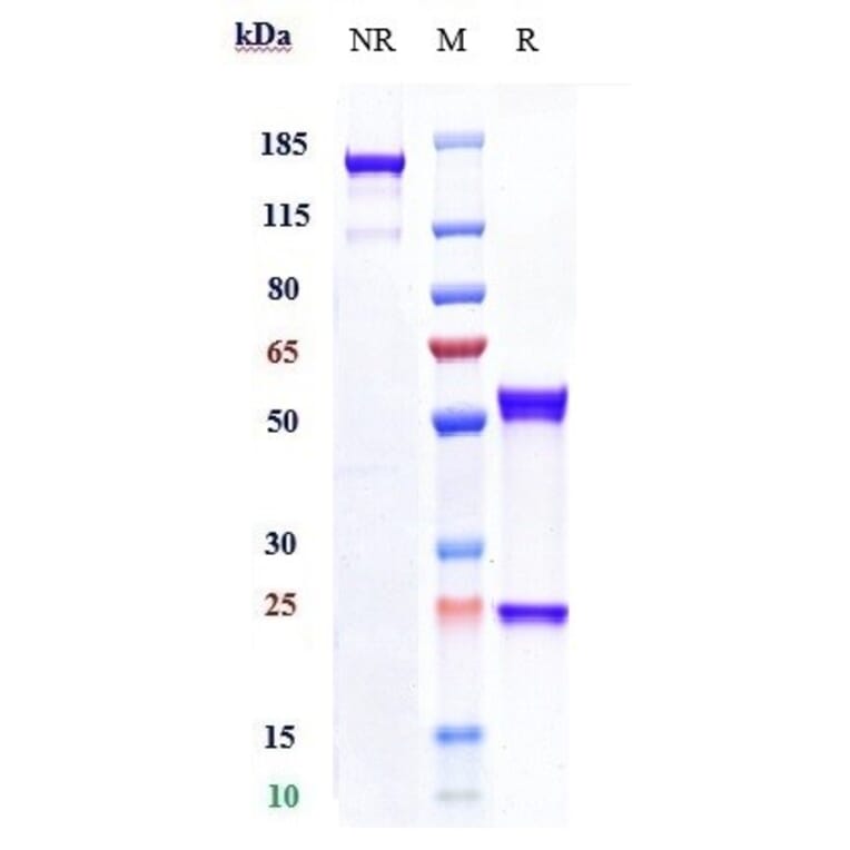 SDS-PAGE - Anti-uPA Receptor/U-PAR Antibody [ATN-658] - Low endotoxin, Azide free (A323866) - Antibodies.com