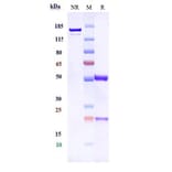 SDS-PAGE - Anti-5T4 Antibody [PF-06263507] - Low endotoxin, Azide free (A323871) - Antibodies.com