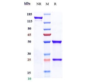 SDS-PAGE - Anti-ABCB5 Antibody [Research Grade Biosimilar] - Low endotoxin, Azide free (A323873) - Antibodies.com