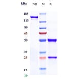 SDS-PAGE - Anti-ABCB5 Antibody [Research Grade Biosimilar] - Low endotoxin, Azide free (A323873) - Antibodies.com